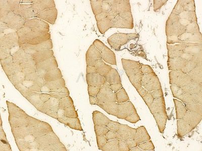 ST7 Mouse Monoclonal Antibody - BF8588 at 1/100 staining rat muscle tissue by IHC-P.