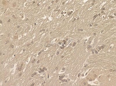 SCAI Mouse Monoclonal Antibody - BF8589 at 1/100 staining rat brain tissue by IHC-P.