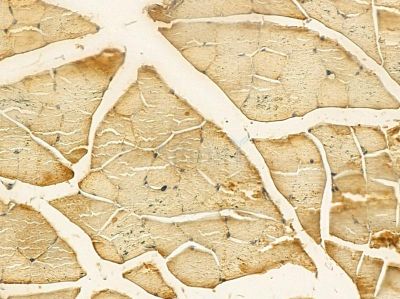 CDK5RAP1 Mouse Monoclonal Antibody - BF8604 at 1/100 staining mouse muscle tissue by IHC-P.