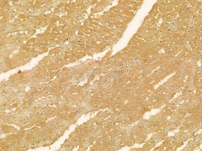 CDK5RAP1 Mouse Monoclonal Antibody - BF8604 at 1/100 staining rat heart tissue by IHC-P.