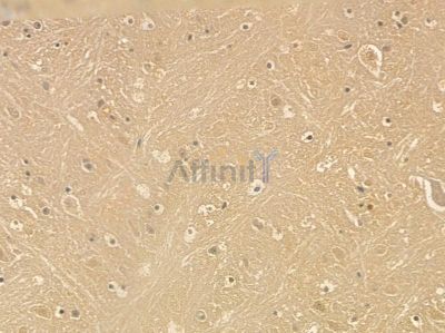 MAP2 Mouse Monoclonal Antibody - BF8607 at 1/100 staining mouse brain tissue by IHC-P.