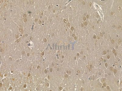 PPP1CA Mouse Monoclonal Antibody - BF8613 at 1/100 staining rat brain tissue by IHC-P.