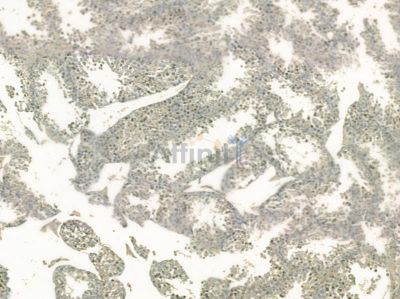 Phospho-FOXO1A (Ser329) Mouse Monoclonal Antibody - BF8616 at 1/100 staining mouse testis tissue by IHC-P.