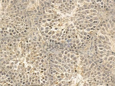 FAM114A2 Mouse Monoclonal Antibody - BF8634 at 1/100 staining mouse testis tissue by IHC-P.