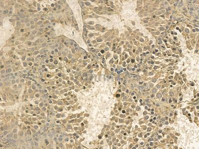 ACAD9 Mouse Monoclonal Antibody - BF8638 at 1/100 staining mouse testis tissue by IHC-P.
