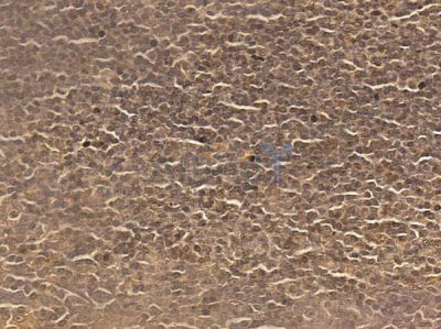 CLP1 Mouse Monoclonal Antibody - BF8649 at 1/100 staining human normal tonsil tissue by IHC-P.