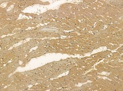 SAA3P Mouse Monoclonal Antibody - BF8650 at 1/100 staining rat heart tissue by IHC-P.