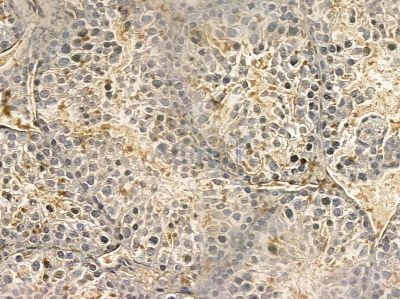 PTPMT1 Mouse Monoclonal Antibody - BF8657 at 1/100 staining mouse testis tissue by IHC-P.