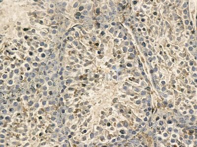 DNAAF1 Mouse Monoclonal Antibody - BF8660 at 1/100 staining mouse testis tissue by IHC-P.