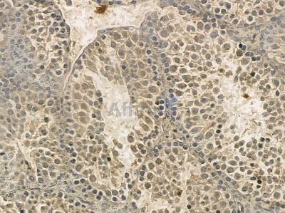 BAHD1 Mouse Monoclonal Antibody - BF8661 at 1/100 staining mouse testis tissue by IHC-P.