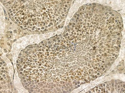 BAHD1 Mouse Monoclonal Antibody - BF8661 at 1/100 staining rat testis tissue by IHC-P.