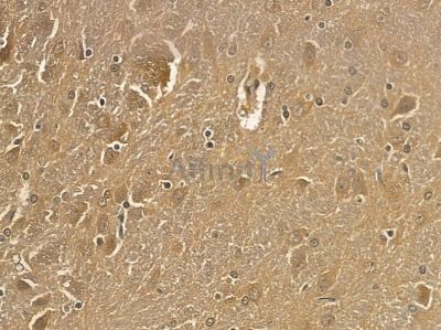SNPH Mouse Monoclonal Antibody - BF8681 at 1/100 staining rat brain tissue by IHC-P.