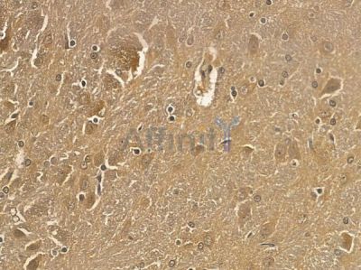 SNPH Mouse Monoclonal Antibody - BF8681 at 1/100 staining rat brain tissue by IHC-P.