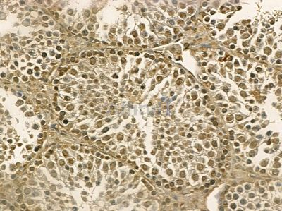 DHX32 Mouse Monoclonal Antibody - BF8683 at 1/100 staining mouse testis tissue by IHC-P.