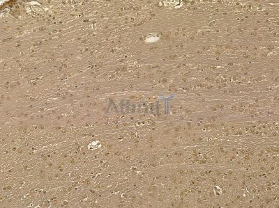 DHX32 Mouse Monoclonal Antibody - BF8683 at 1/100 staining rat brain tissue by IHC-P.