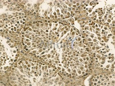 DHX32 Mouse Monoclonal Antibody - BF8683 at 1/100 staining mouse testis tissue by IHC-P.