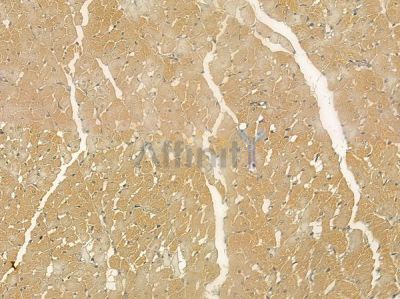 TIPRL Mouse Monoclonal Antibody - BF8684 at 1/100 staining rat heart tissue by IHC-P.