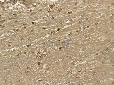 LBX1 Mouse Monoclonal Antibody - BF8701 at 1/100 staining rat brain tissue by IHC-P.