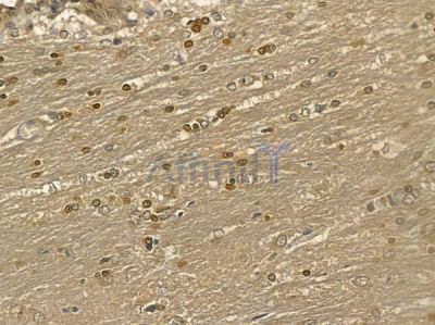 LBX1 Mouse Monoclonal Antibody - BF8701 at 1/100 staining rat brain tissue by IHC-P.