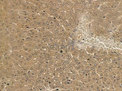 MOGAT2 Mouse Monoclonal Antibody - BF8702 at 1/100 staining rat liver tissue by IHC-P.