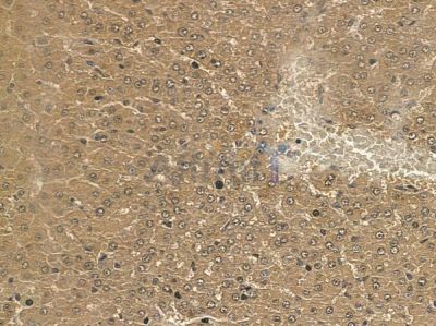 MOGAT2 Mouse Monoclonal Antibody - BF8702 at 1/100 staining rat liver tissue by IHC-P.
