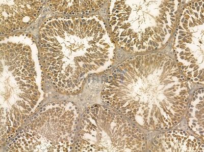 NSUN5 Mouse Monoclonal Antibody - BF8706 at 1/100 staining rat testis tissue by IHC-P.