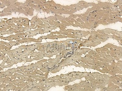 LMOD2 Mouse Monoclonal Antibody - BF8708 at 1/100 staining rat heart tissue by IHC-P.