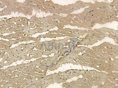 LMOD2 Mouse Monoclonal Antibody - BF8708 at 1/100 staining rat heart tissue by IHC-P.