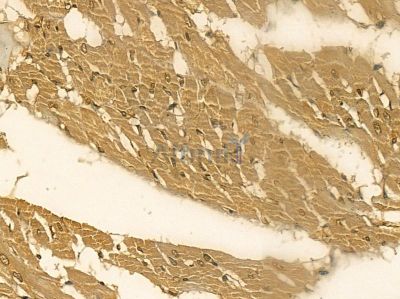 CRYGS Mouse Monoclonal Antibody - BF8714 at 1/100 staining rat heart tissue by IHC-P.
