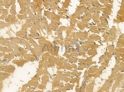 TRIM67 Mouse Monoclonal Antibody - BF8716 at 1/100 staining rat heart tissue by IHC-P.