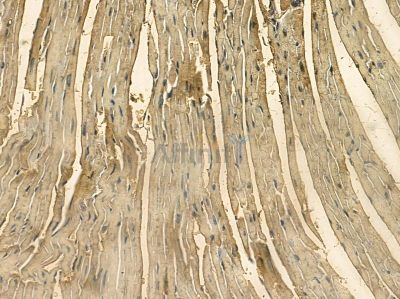 TNNI2 Mouse Monoclonal Antibody - BF8719 at 1/100 staining mouse heart tissue by IHC-P.