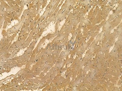 TNNI2 Mouse Monoclonal Antibody - BF8719 at 1/100 staining rat heart tissue by IHC-P.