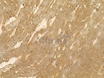 TNNI2 Mouse Monoclonal Antibody - BF8719 at 1/100 staining rat heart tissue by IHC-P.