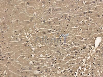 RASAL1 Mouse Monoclonal Antibody - BF8720 at 1/100 staining mouse brain tissue by IHC-P.