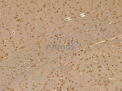 RWDD2B Mouse Monoclonal Antibody - BF8721 at 1/100 staining rat brain tissue by IHC-P.