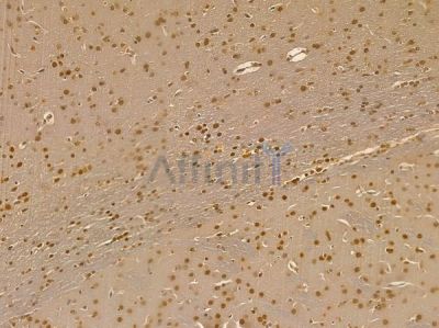 RWDD2B Mouse Monoclonal Antibody - BF8721 at 1/100 staining rat brain tissue by IHC-P.