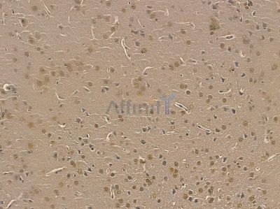 ZFX Mouse Monoclonal Antibody - BF8722 at 1/100 staining rat brain tissue by IHC-P.