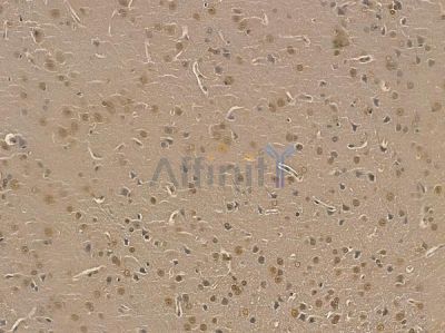 ZFX Mouse Monoclonal Antibody - BF8722 at 1/100 staining rat brain tissue by IHC-P.