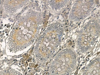 XRRA1 Mouse Monoclonal Antibody - BF8760 at 1/100 staining rat testis tissue by IHC-P.