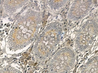 XRRA1 Mouse Monoclonal Antibody - BF8760 at 1/100 staining human normal colon tissue by IHC-P.