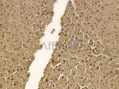 SARS Mouse Monoclonal Antibody - BF8762 at 1/100 staining human normal liver tissue by IHC-P.