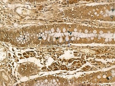 WDR70 Mouse Monoclonal Antibody - BF8763 at 1/100 staining rat testis tissue by IHC-P.