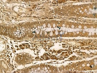 WDR70 Mouse Monoclonal Antibody - BF8763 at 1/100 staining human normal colon tissue by IHC-P.