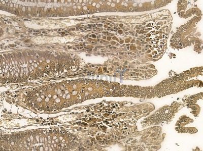 ZNF226 Mouse Monoclonal Antibody - BF8765 at 1/100 staining rat testis tissue by IHC-P.