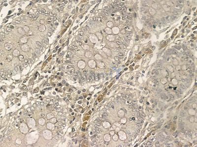 ARMC9 Mouse Monoclonal Antibody - BF8769 at 1/100 staining rat testis tissue by IHC-P.