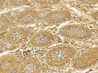 IGF2BP3 Mouse Monoclonal Antibody - BF8771 at 1/100 staining rat testis tissue by IHC-P.