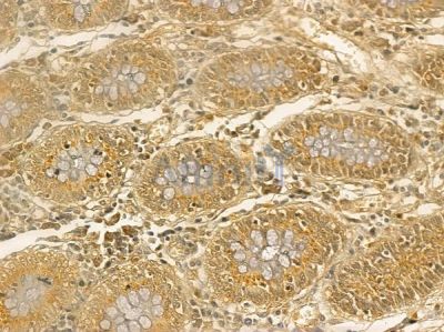 IGF2BP3 Mouse Monoclonal Antibody - BF8771 at 1/100 staining human normal colon tissue by IHC-P.
