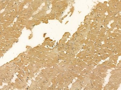 TMEM63C Mouse Monoclonal Antibody - BF8898 at 1/100 staining rat heart tissue by IHC-P.