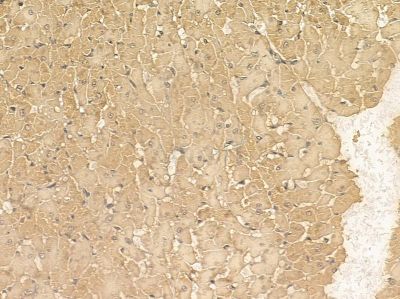 Scavenger Receptor BII Mouse Monoclonal Antibody - BF8913 at 1/100 staining rat heart tissue by IHC-P.