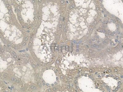 UBE2E3 Antibody - DF10000 at 1/100 staining human normal kidney tissue by IHC-P.